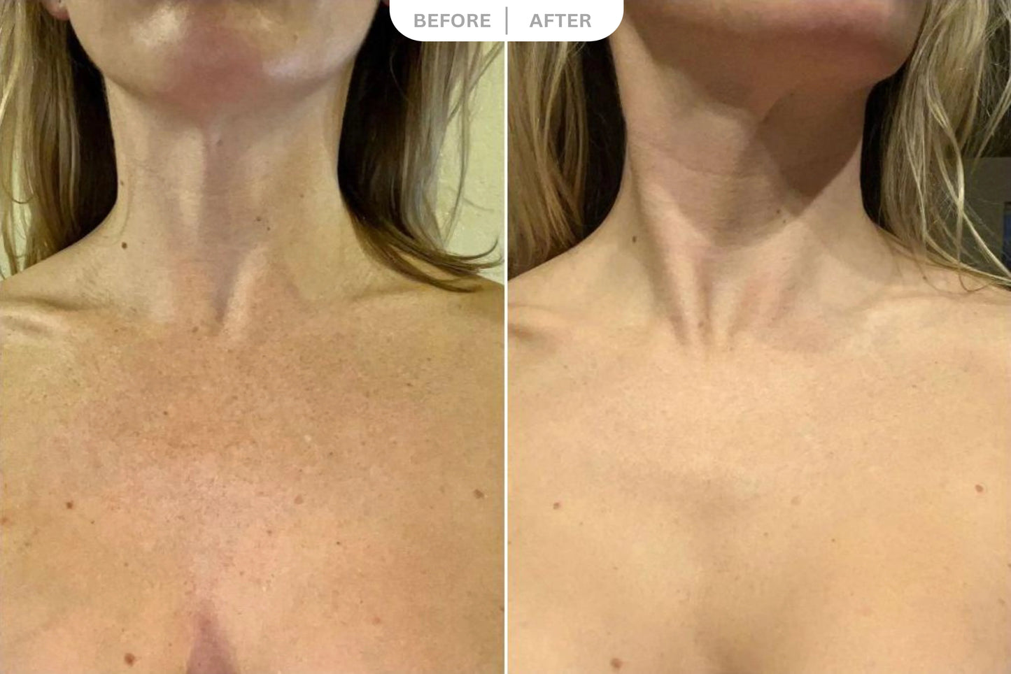 FREE QuickLift LED Neck & Jawline Device ($69.99 Value)
