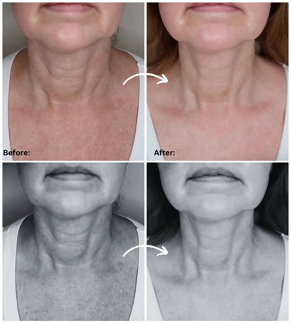 FREE QuickLift LED Neck & Jawline Device ($69.99 Value)