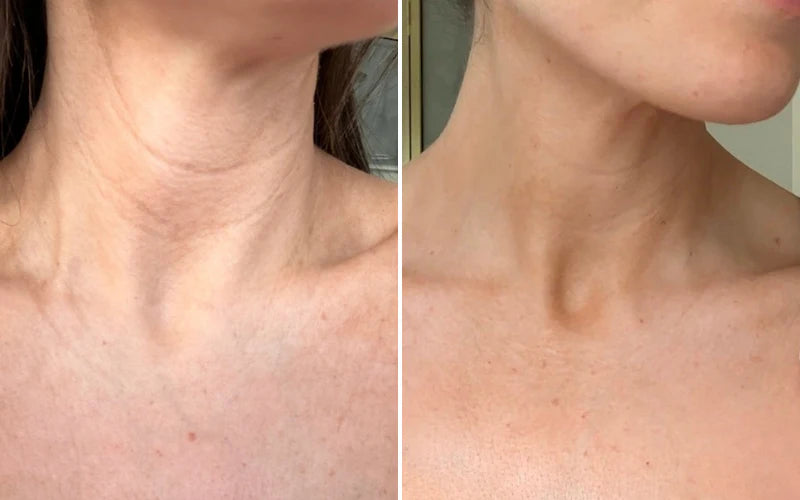 FREE QuickLift LED Neck & Jawline Device ($69.99 Value)